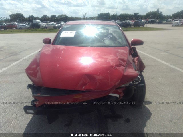 Photo 5 VIN: 5NPD84LF0JH232281 - HYUNDAI ELANTRA 