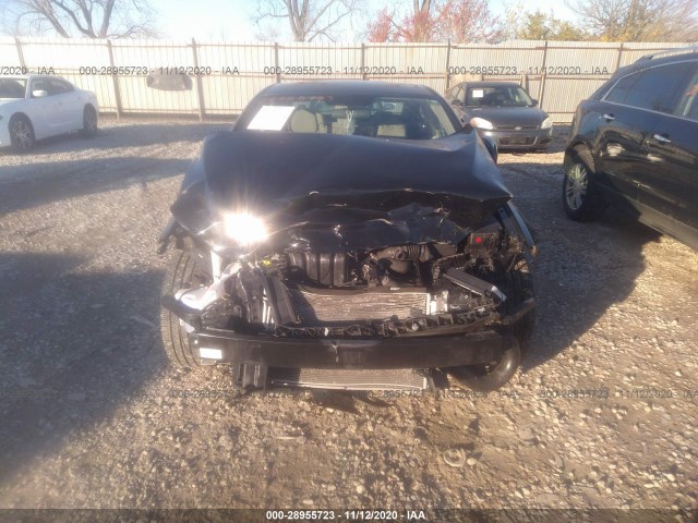 Photo 5 VIN: 5NPD84LF1HH129557 - HYUNDAI ELANTRA 