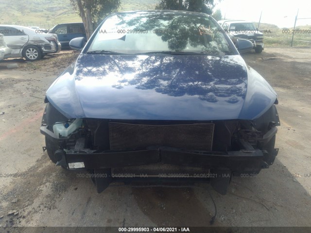 Photo 5 VIN: 5NPD84LF6JH213542 - HYUNDAI ELANTRA 