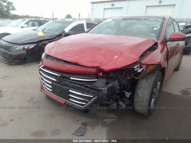 Photo 5 VIN: 5NPD84LF9JH316390 - HYUNDAI ELANTRA 