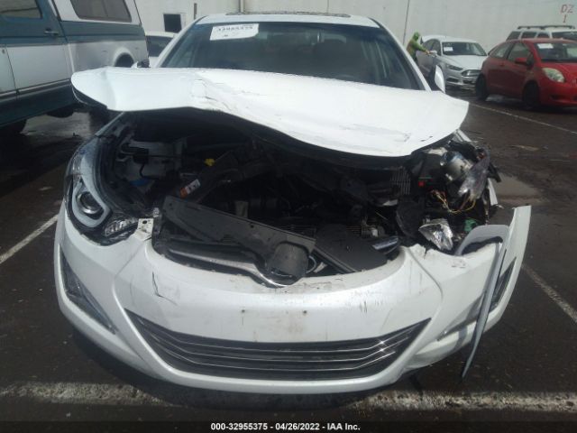 Photo 5 VIN: 5NPDH4AE0FH628406 - HYUNDAI ELANTRA 