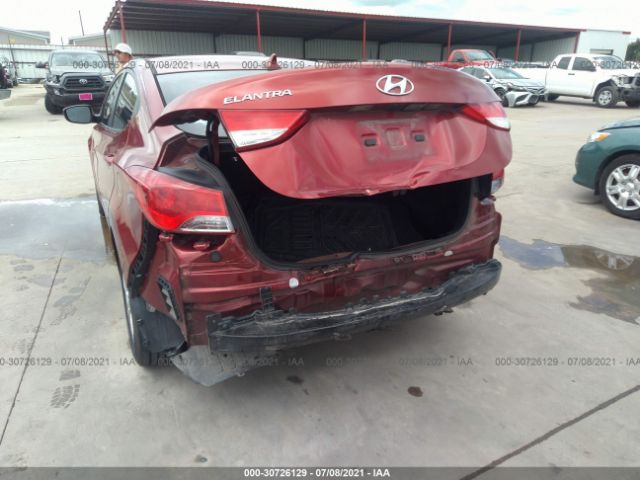 Photo 5 VIN: 5NPDH4AE1DH386478 - HYUNDAI ELANTRA 