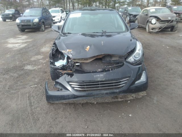 Photo 5 VIN: 5NPDH4AE1EH476540 - HYUNDAI ELANTRA 