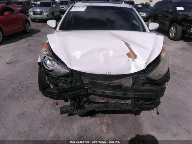 Photo 5 VIN: 5NPDH4AE2CH149139 - HYUNDAI ELANTRA 