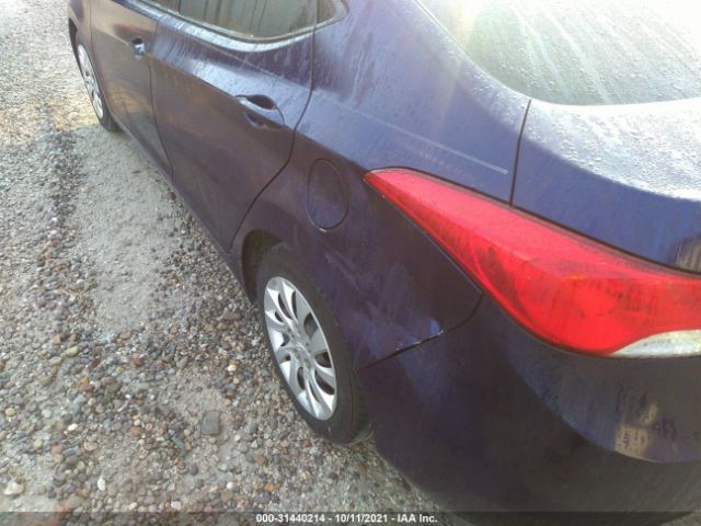 Photo 5 VIN: 5NPDH4AE2DH155010 - HYUNDAI ELANTRA 