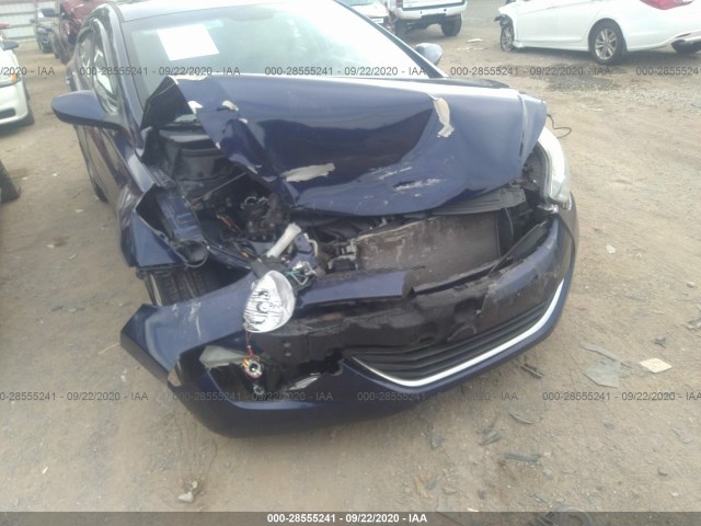 Photo 5 VIN: 5NPDH4AE3DH176982 - HYUNDAI ELANTRA 