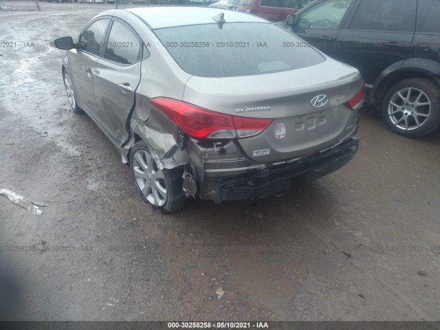 Photo 5 VIN: 5NPDH4AE4BH046769 - HYUNDAI ELANTRA 