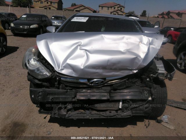 Photo 5 VIN: 5NPDH4AE4CH071284 - HYUNDAI ELANTRA 