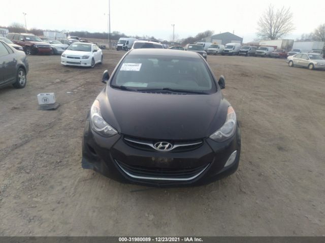 Photo 5 VIN: 5NPDH4AE4CH098176 - HYUNDAI ELANTRA 