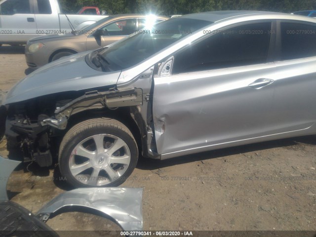 Photo 5 VIN: 5NPDH4AE4CH113906 - HYUNDAI ELANTRA 