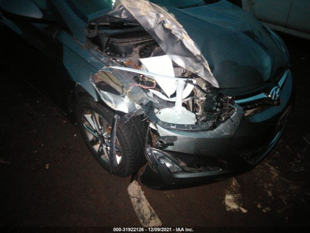 Photo 5 VIN: 5NPDH4AE5EH472409 - HYUNDAI ELANTRA 