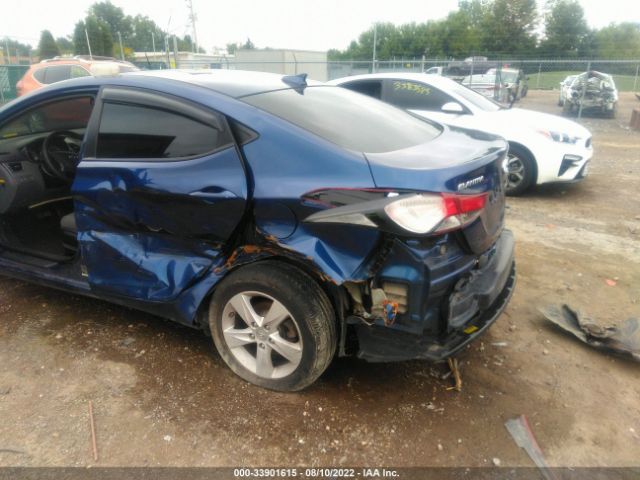 Photo 5 VIN: 5NPDH4AE5GH758831 - HYUNDAI ELANTRA 