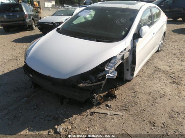 Photo 5 VIN: 5NPDH4AE6CH111655 - HYUNDAI ELANTRA 