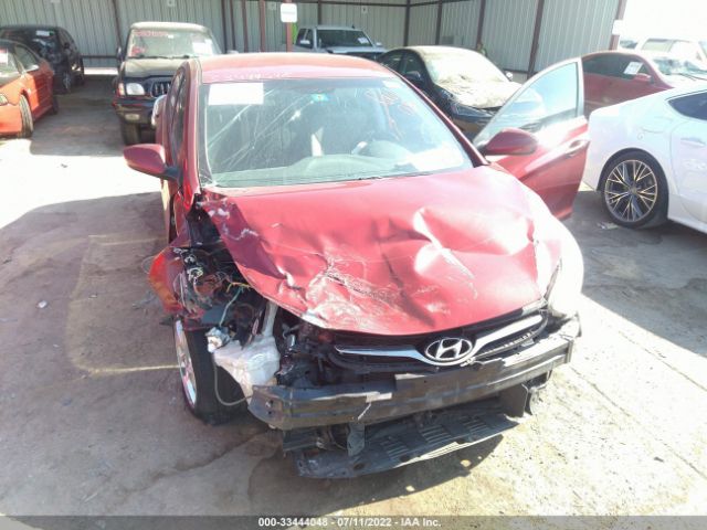 Photo 5 VIN: 5NPDH4AE6EH538157 - HYUNDAI ELANTRA 