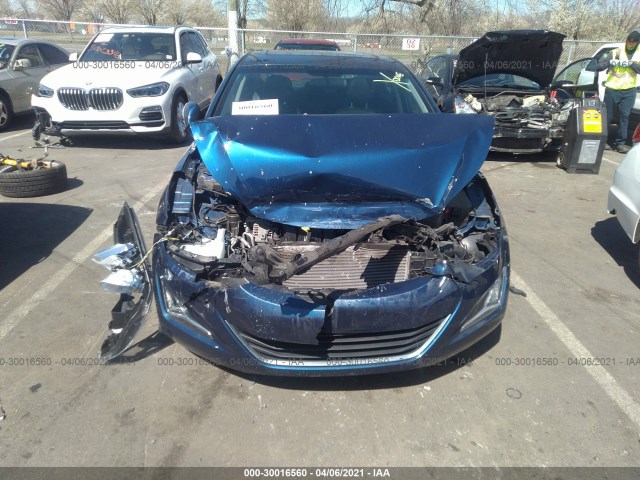 Photo 5 VIN: 5NPDH4AE6GH722758 - HYUNDAI ELANTRA 