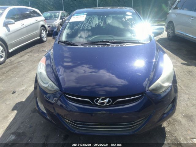 Photo 5 VIN: 5NPDH4AE7CH101104 - HYUNDAI ELANTRA 