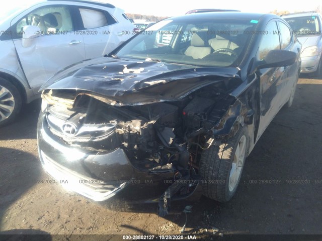 Photo 5 VIN: 5NPDH4AE7DH367174 - HYUNDAI ELANTRA 