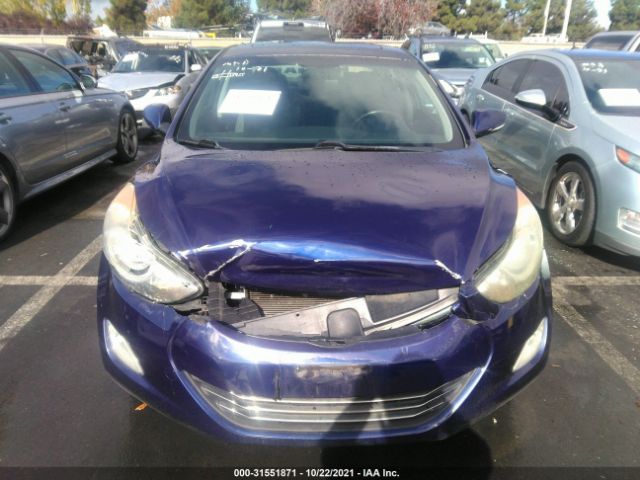 Photo 5 VIN: 5NPDH4AE8BH051540 - HYUNDAI ELANTRA 