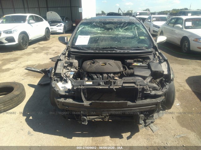 Photo 5 VIN: 5NPDH4AE8CH083454 - HYUNDAI ELANTRA 