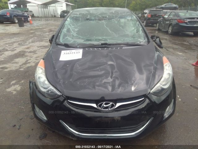 Photo 5 VIN: 5NPDH4AE8DH378524 - HYUNDAI ELANTRA 