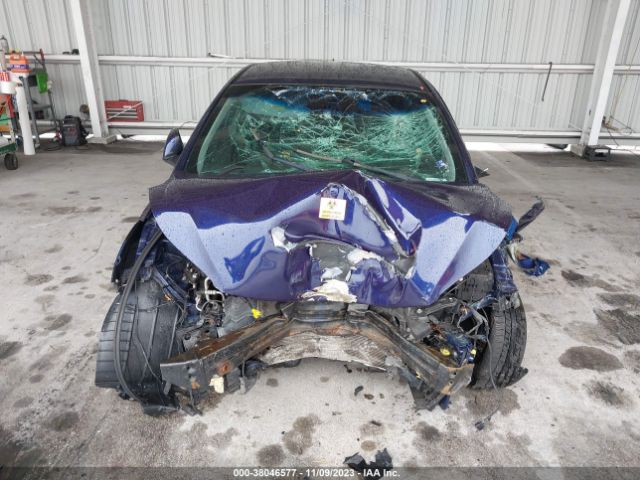 Photo 5 VIN: 5NPDH4AE8EH478575 - HYUNDAI ELANTRA 