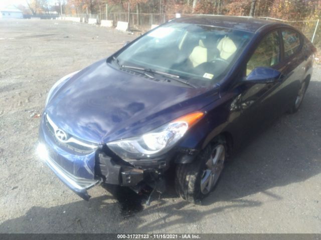 Photo 1 VIN: 5NPDH4AE9DH251944 - HYUNDAI ELANTRA 