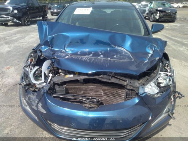 Photo 5 VIN: 5NPDH4AE9GH796272 - HYUNDAI ELANTRA 