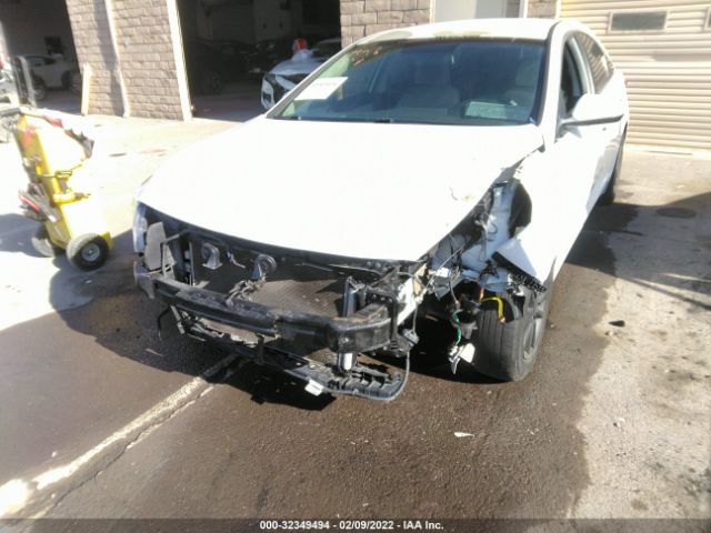 Photo 5 VIN: 5NPE24AF3HH539754 - HYUNDAI SONATA 