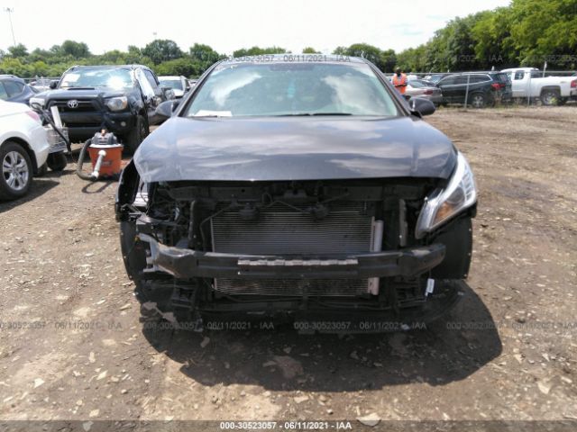 Photo 5 VIN: 5NPE24AF4HH549614 - HYUNDAI SONATA 