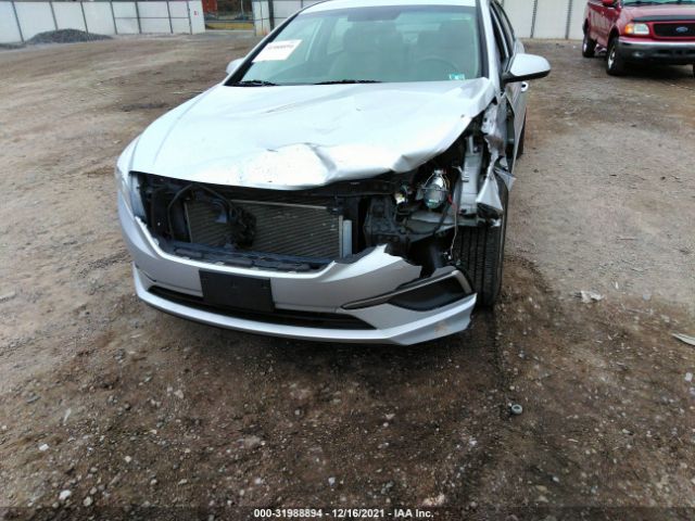 Photo 5 VIN: 5NPE24AF5HH515925 - HYUNDAI SONATA 