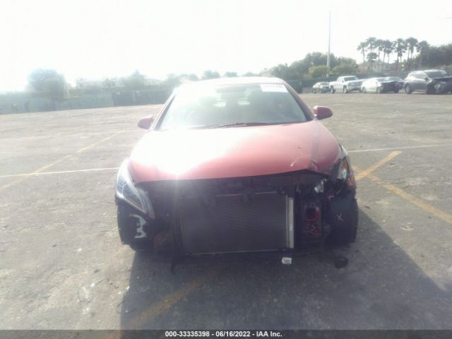 Photo 5 VIN: 5NPE24AFXHH525835 - HYUNDAI SONATA 