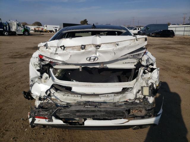 Photo 5 VIN: 5NPE34AF0FH250647 - HYUNDAI SONATA SPO 