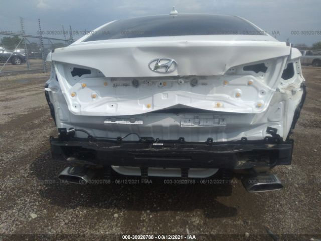 Photo 5 VIN: 5NPE34AF0HH574863 - HYUNDAI SONATA 