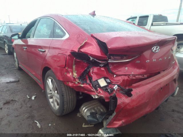 Photo 5 VIN: 5NPE34AF6JH596453 - HYUNDAI SONATA 