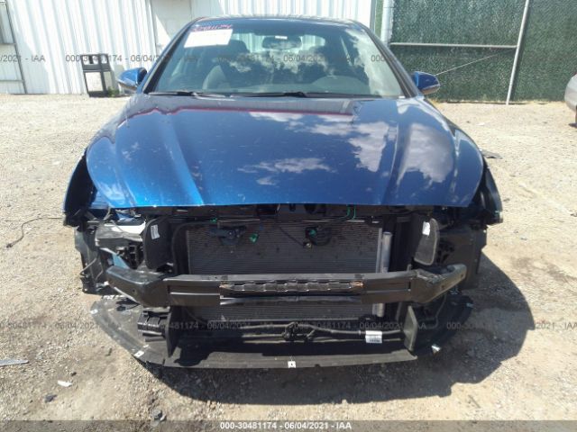 Photo 5 VIN: 5NPE34AF8JH689765 - HYUNDAI SONATA 