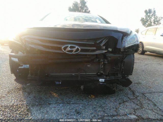 Photo 5 VIN: 5NPE34AF9HH584386 - HYUNDAI SONATA 