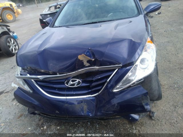 Photo 5 VIN: 5NPEB4AC6DH572408 - HYUNDAI SONATA 