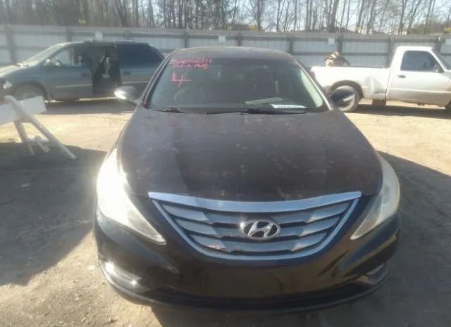 Photo 5 VIN: 5NPEC4AB2BH305011 - HYUNDAI SONATA 