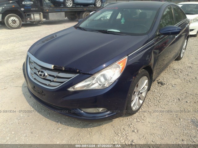 Photo 5 VIN: 5NPEC4AB5BH177217 - HYUNDAI SONATA 