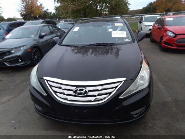 Photo 5 VIN: 5NPEC4AB5BH177315 - HYUNDAI SONATA 