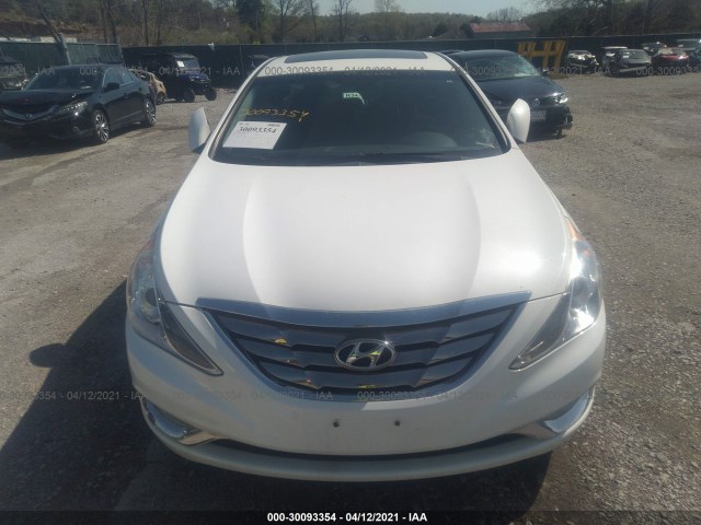 Photo 5 VIN: 5NPEC4ABXCH481709 - HYUNDAI SONATA SE 