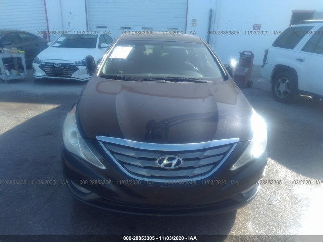 Photo 5 VIN: 5NPEC4AC1BH141341 - HYUNDAI SONATA 