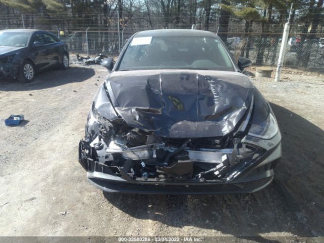 Photo 5 VIN: 5NPEJ4J23MH097486 - HYUNDAI SONATA 