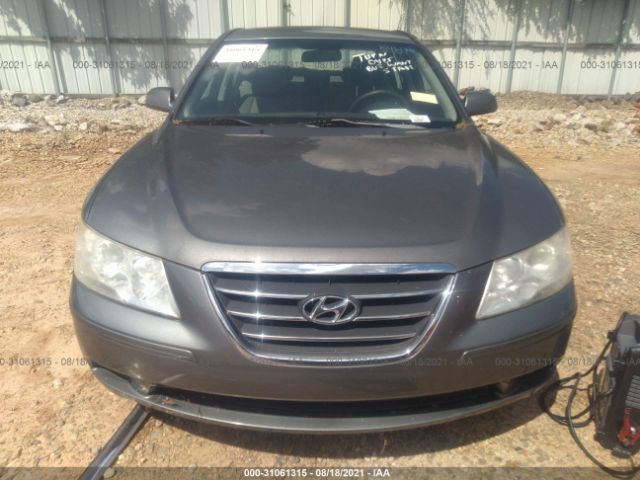 Photo 5 VIN: 5NPET4AC7AH645665 - HYUNDAI SONATA 