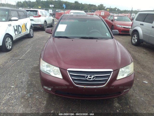 Photo 5 VIN: 5NPEU4AC9AH589337 - HYUNDAI SONATA 