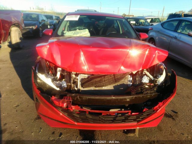 Photo 5 VIN: 5NPLM4AG7MH048513 - HYUNDAI ELANTRA 