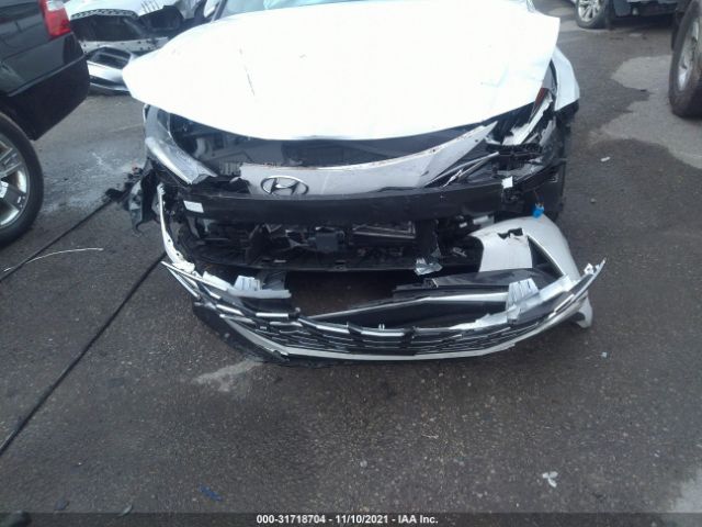 Photo 5 VIN: 5NPLN4AG4MH035103 - HYUNDAI ELANTRA 