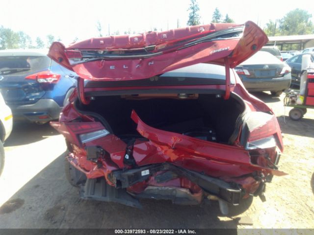 Photo 5 VIN: 5NPLP4AG2MH003681 - HYUNDAI ELANTRA 