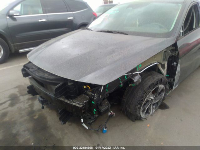 Photo 5 VIN: 5NPLS4AG2MH040258 - HYUNDAI ELANTRA 