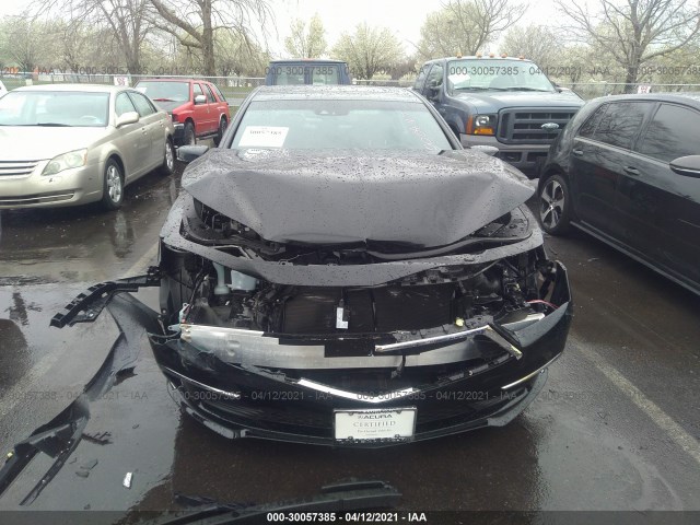 Photo 5 VIN: JH4KC1F54LC000447 - ACURA RLX 